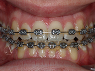 Progressive - Ali Orthodontics Dental