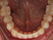 Progressive - Ali Orthodontics Dental