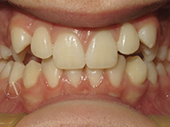 Progressive - Ali Orthodontics Dental