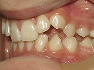 Progressive - Ali Orthodontics Dental