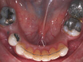 After - Ali Orthodontics Dental