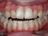 Before - Ali Orthodontics Dental