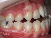 Before - Ali Orthodontics Dental