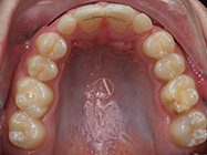 After - Ali Orthodontics Dental