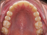 After - Ali Orthodontics Dental