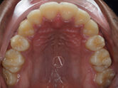 After - Ali Orthodontics Dental