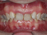 Before - Ali Orthodontics Dental
