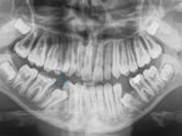 Before - Ali Orthodontics Dental