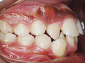 Before - Ali Orthodontics Dental