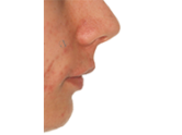 Before - Ali Orthodontics Dental