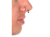 After - Ali Orthodontics Dental