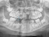 Before - Ali Orthodontics Dental