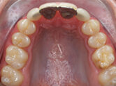 After - Ali Orthodontics Dental
