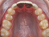 After - Ali Orthodontics Dental