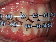 Progressive - Ali Orthodontics Dental