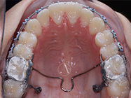 Progressive - Ali Orthodontics Dental
