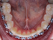 Progressive - Ali Orthodontics Dental