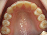 After - Ali Orthodontics Dental