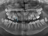 Before - Ali Orthodontics Dental