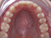 After - Ali Orthodontics Dental