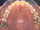 Before - Ali Orthodontics Dental